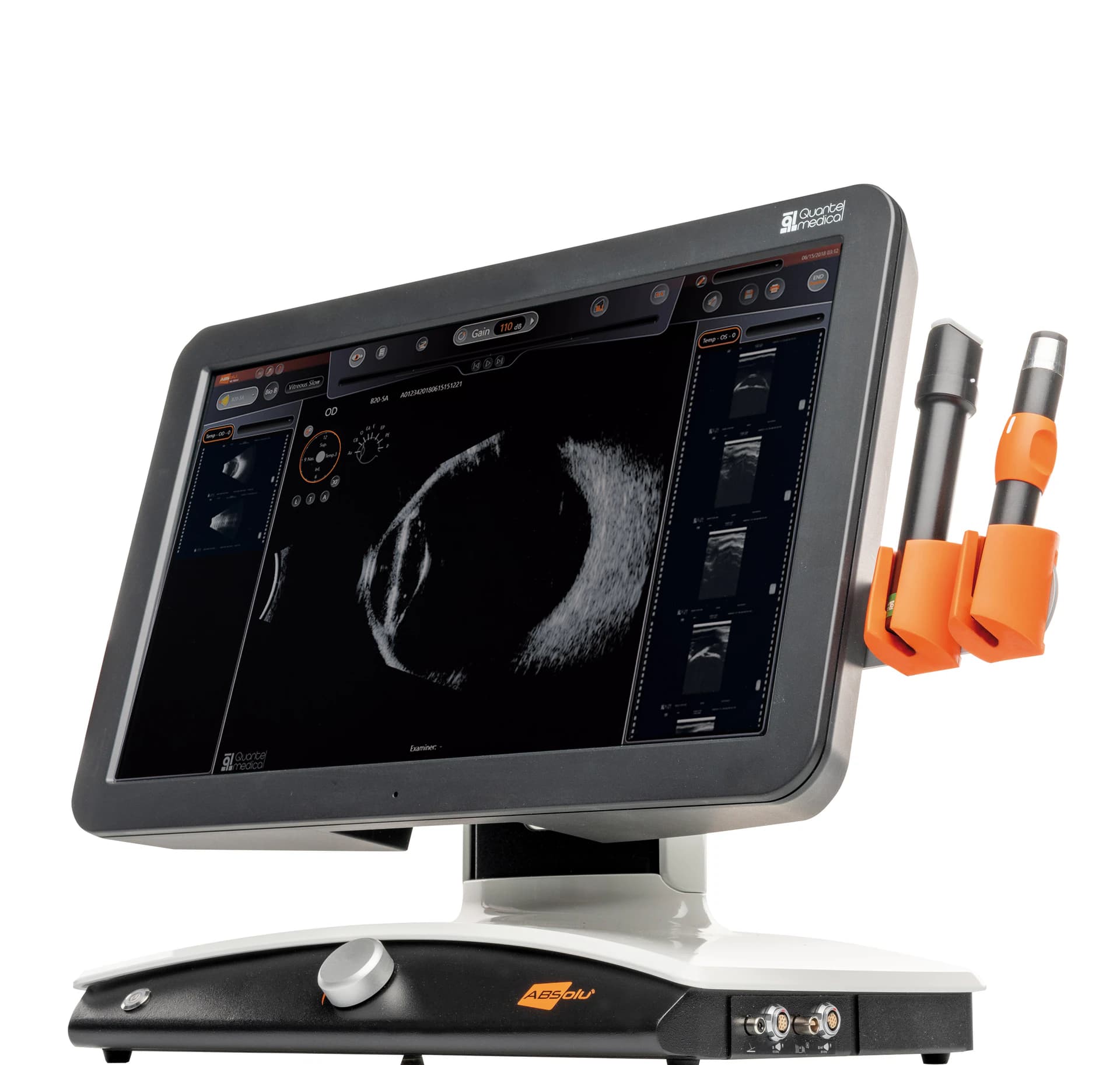 Oftalmik Ultrasonlar