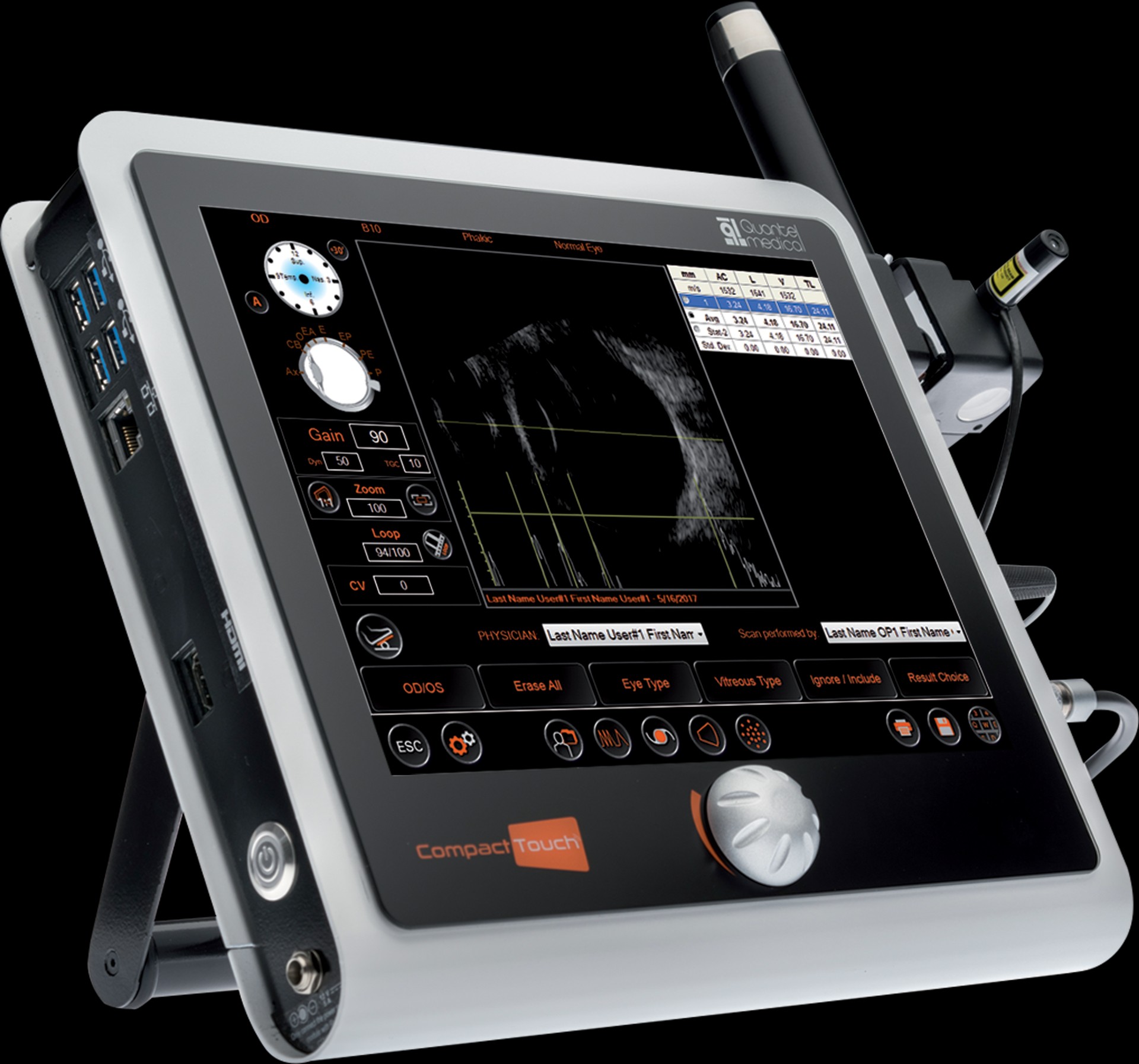 Compact Touch A/B/P Kombine Ultrason