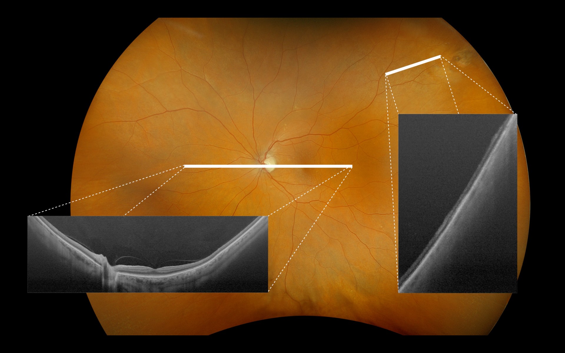 California
