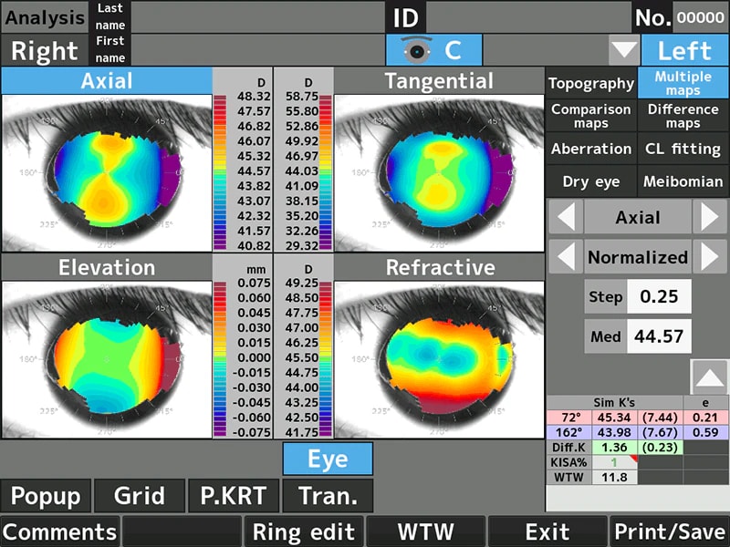 RET-700 Otorefkerato-Topografi