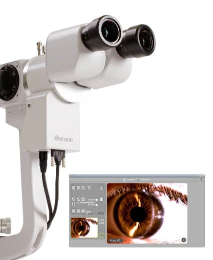 RS-5000 Biyomikroskop + DCS-700 Dijital Kamera Sistemi